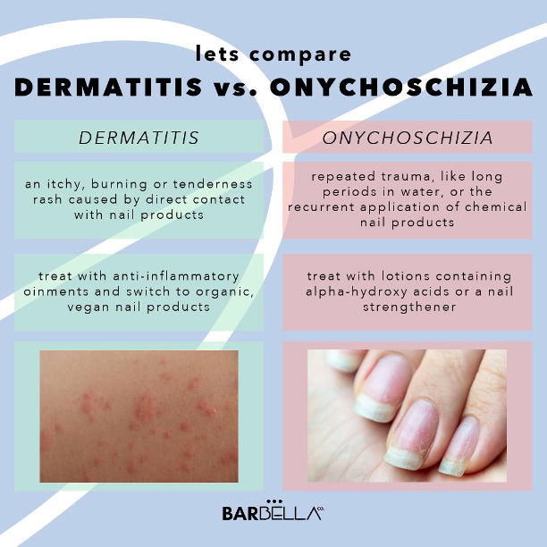Dermatitis vs. Onychoschizia