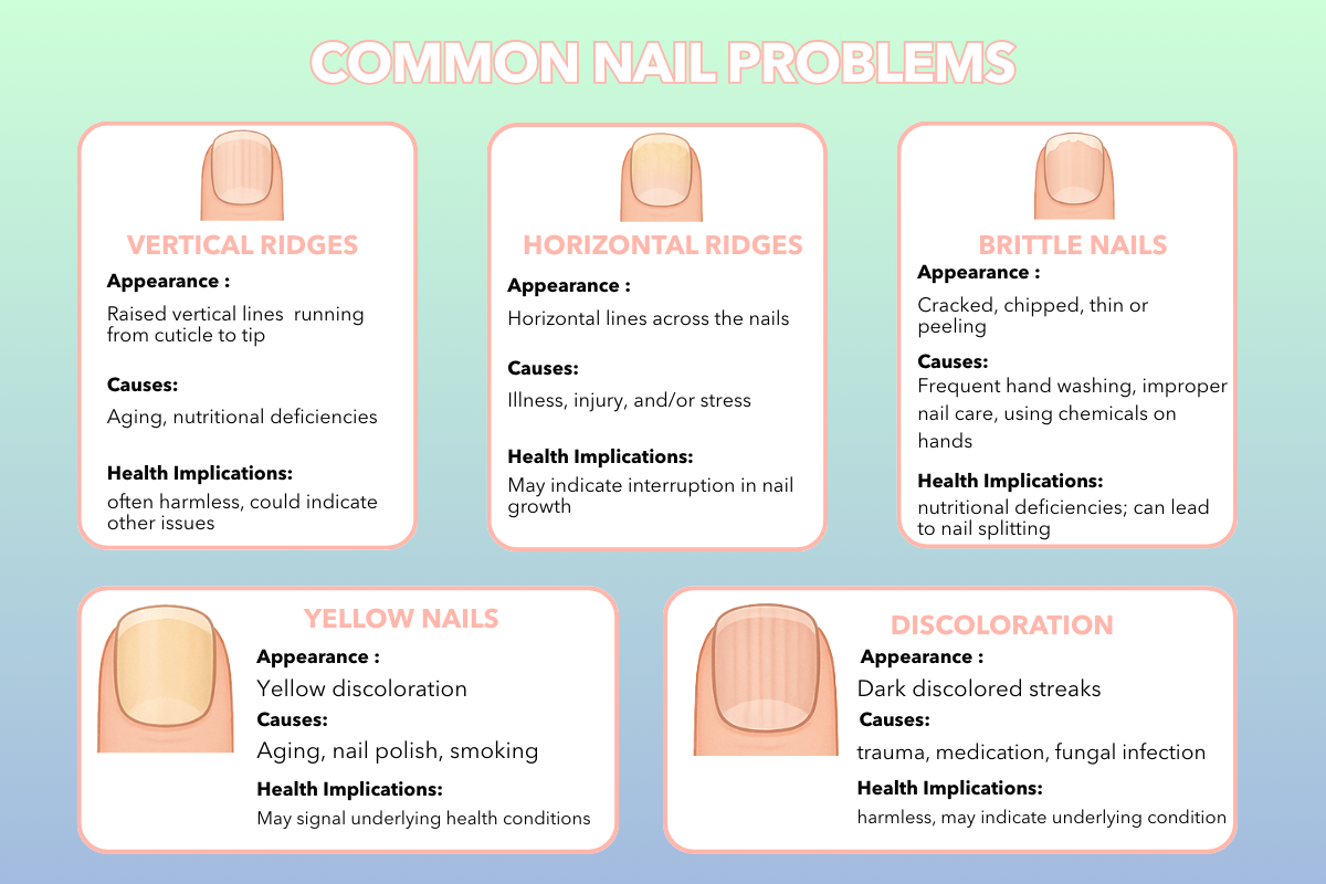 Infographic titled "Common Nail Problems" with five illustrated cards describing nail issues, their causes and solutions, on a mint to blue gradient.